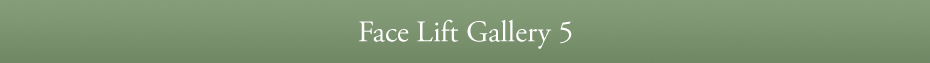 Face Lift Gallery 5