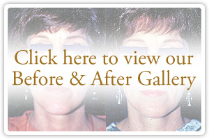 Click here to view our Before & After Gallery