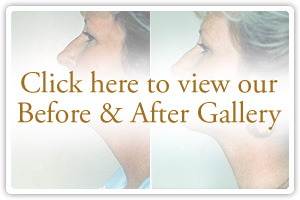 Click here to view our Before & After Gallery